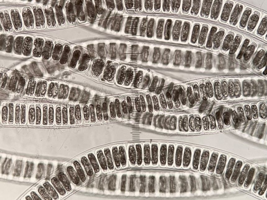 Microscopy picture algae