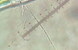 Microscopy picture algae