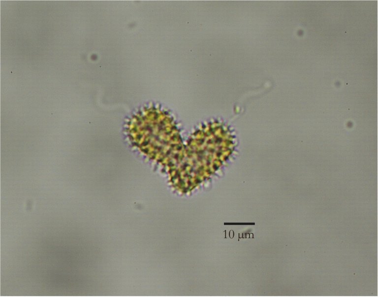 Mikroskop bilde av  Pseudochattonella