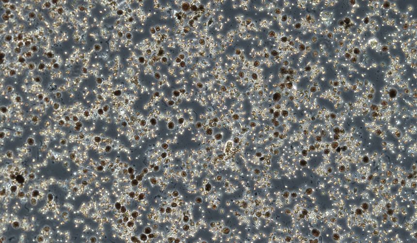 thousands of algaes on blue background